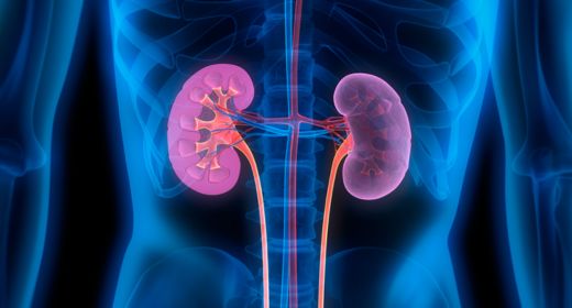 Polycystic Kidney Disease (PKD) Care